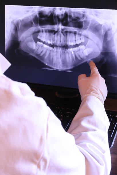 Best Mobile Emergency Dentist in Argos, IN
